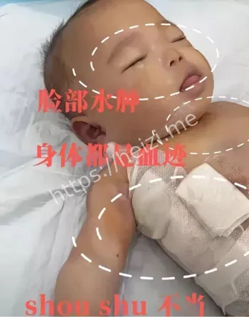 宁波早产儿小洛熙